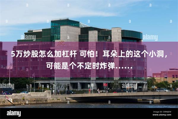 5万炒股怎么加杠杆 可怕！耳朵上的这个小洞，可能是个不定时炸弹……